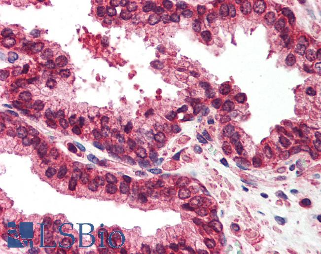 Anti-EMD / Emerin antibody IHC of human prostate. Immunohistochemistry of formalin-fixed, paraffin-embedded tissue after heat-induced antigen retrieval. Antibody LS-B565 concentration 5 ug/ml.