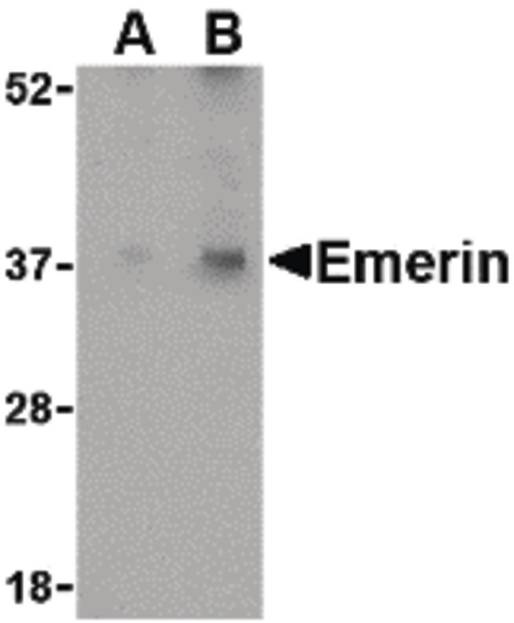 Western blot of Emerin in human skeletal muscle tissue lysate with Emerin antibody at (A) 0.5 and (B) 1 ug/ml.