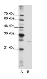 A: Marker, B: HepG2 Cell Lysate