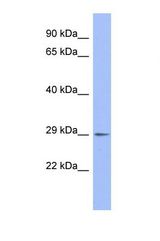 Western blot of Human THP-1. EMG1 antibody dilution 1.0 ug/ml.