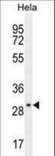 EMG1 Antibody western blot of HeLa cell line lysates (35 ug/lane). The EMG1 antibody detected the EMG1 protein (arrow).