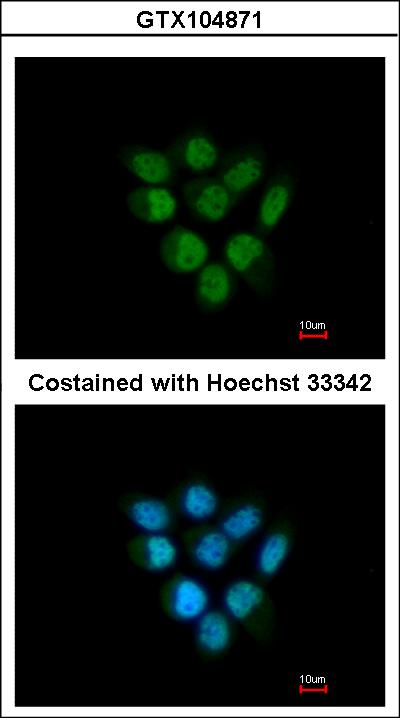 Immunofluorescence of paraformaldehyde-fixed A431 using FBXO43 antibody at 1:200 dilution.