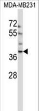 EMID1 Antibody western blot of MDA-MB231 cell line lysates (35 ug/lane). The EMID1 antibody detected the EMID1 protein (arrow).