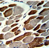 Formalin-fixed and paraffin-embedded human skeletal muscle with EMILIN1 Antibody , which was peroxidase-conjugated to the secondary antibody, followed by DAB staining. This data demonstrates the use of this antibody for immunohistochemistry; clinical relevance has not been evaluated.