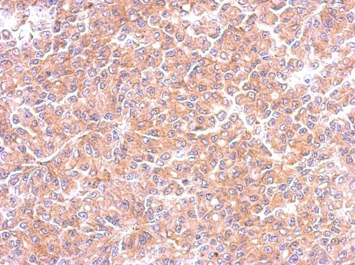 IHC of paraffin-embedded RF48 xenograft using EML1 antibody at 1:500 dilution.