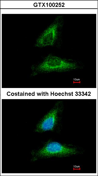 Immunofluorescence of methanol-fixed HeLa using EML1 antibody at 1:500 dilution.