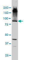 EML1 monoclonal antibody (M01A), clone 5G3 Western Blot analysis of EML1 expression in HepG2.