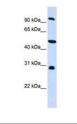 HepG2 cell lysate. Antibody concentration: 1.0 ug/ml. Gel concentration: 12%.