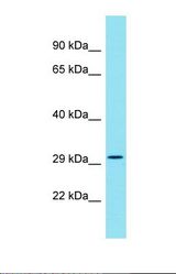 Western blot of Human HT1080. EML5 antibody dilution 1.0 ug/ml.