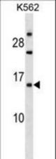 EMP1 Antibody western blot of K562 cell line lysates (35 ug/lane). The EMP1 antibody detected the EMP1 protein (arrow).