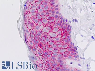 Anti-EMP2 antibody IHC staining of human skin, epidermis. Immunohistochemistry of formalin-fixed, paraffin-embedded tissue after heat-induced antigen retrieval.