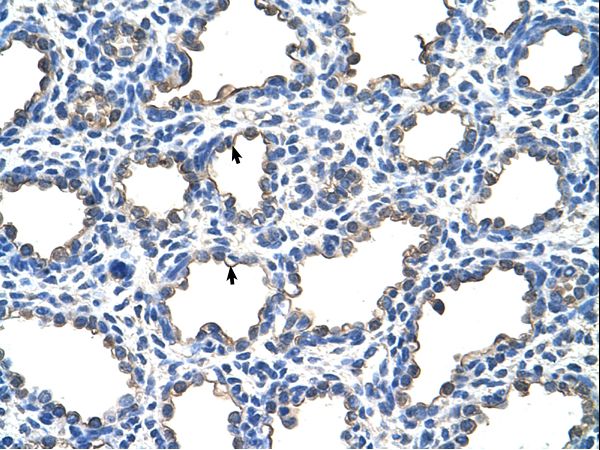 EMP2 antibody LS-C31949 was used in IHC to stain formalin-fixed, paraffin-embedded human lung.