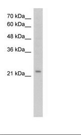 HepG2 Cell Lysate