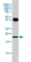 EMP3 monoclonal antibody (M01), clone 3D4 Western blot of EMP3 expression in C32.