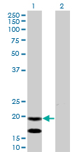 Western blot of EMP3 expression in transfected 293T cell line by EMP3 monoclonal antibody (M01), clone 3D4.