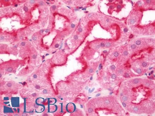 Human Kidney: Formalin-Fixed, Paraffin-Embedded (FFPE)