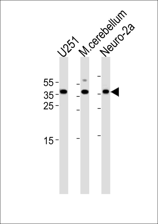 EMX1 Antibody western blot of U251 and Neuro-2a cell line mouse cerebellum tissue lysates (35 ug/lane). The EMX1 antibody detected the EMX1 protein (arrow).