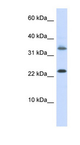 EMX1 antibody LS-C111144 Western blot of HepG2 cell lysate.