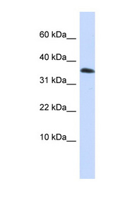 EMX1 antibody LS-C102267 Western blot of HepG2 cell lysate.