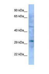 EMX1 antibody LS-C146339 Western blot of Mouse Pancreas lysate. Antibody concentration 1 ug/ml.