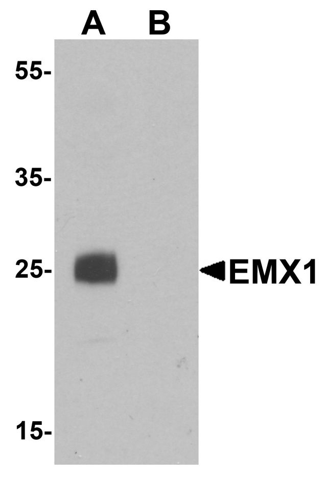Western blot analysis of EMX1 in rat liver tissue lysate with EMX1 antibody at 1 ug/ml in (A) the absence and (B) the presence of blocking peptide.