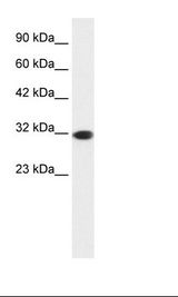 HepG2 Cell Lysate.