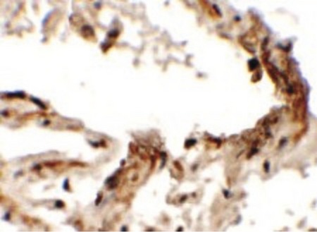 Immunohistochemistry of EMX2 in human lung tissue with EMX2 antibody at 2.5 ug/ml.