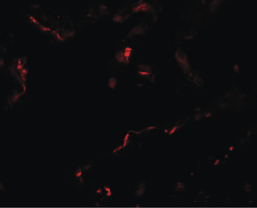 Immunofluorescence of EMX2 in human lung tissue with EMX2 antibody at 20 ug/ml.