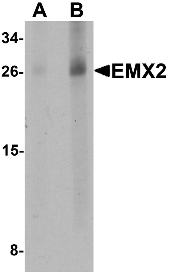 Western blot analysis of EMX2 in human lung tissue lysate with EMX2 antibody at (A) 1 and (B) 2 ug/ml.
