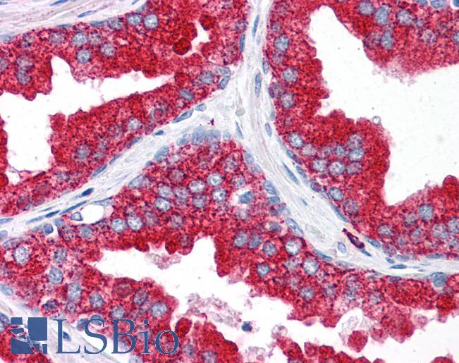 Anti-EMX2 antibody IHC of human prostate. Immunohistochemistry of formalin-fixed, paraffin-embedded tissue after heat-induced antigen retrieval. Antibody LS-B4708 concentration 5 ug/ml.