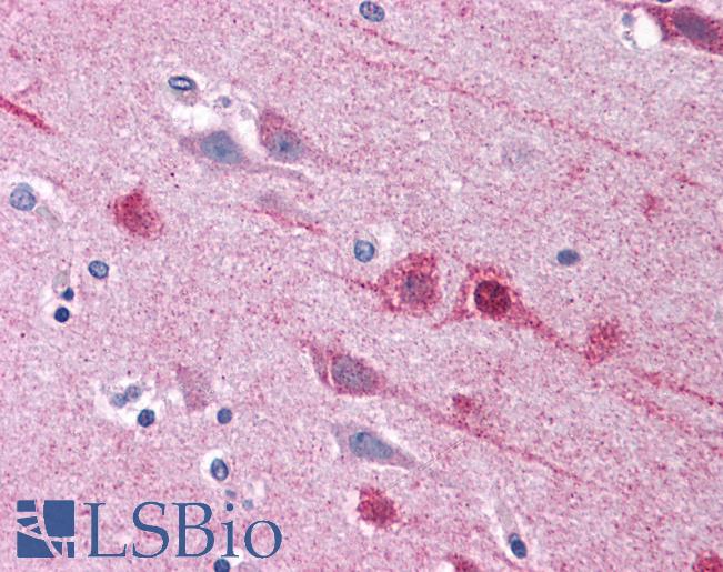 Anti-EMX2 antibody IHC of human brain, cortex. Immunohistochemistry of formalin-fixed, paraffin-embedded tissue after heat-induced antigen retrieval. Antibody LS-B4708 concentration 5 ug/ml.