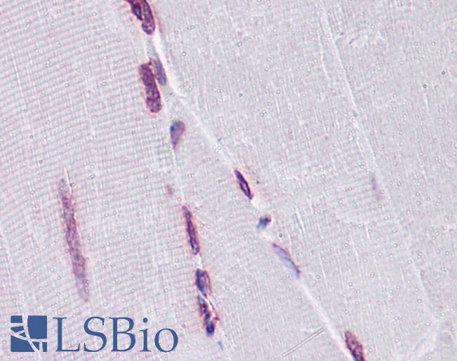 Anti-EMX2 antibody IHC of human skeletal muscle. Immunohistochemistry of formalin-fixed, paraffin-embedded tissue after heat-induced antigen retrieval. Antibody LS-B4317 concentration 5 ug/ml.
