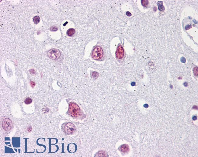 Anti-EMX2 antibody IHC of human brain, cortex. Immunohistochemistry of formalin-fixed, paraffin-embedded tissue after heat-induced antigen retrieval. Antibody LS-B4317 concentration 5 ug/ml.