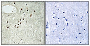 IHC of paraffin-embedded human brain tissue, using EMX2 Antibody. The sample on the right was incubated with synthetic peptide.