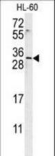 EMX2 Antibody western blot of HL-60 cell line lysates (15 ug/lane). The EMX2 antibody detected the EMX2 protein (arrow).