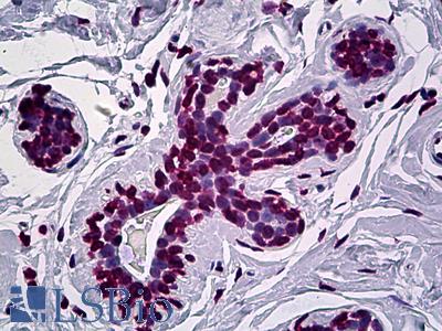 Anti-EN1 antibody IHC of human breast. Immunohistochemistry of formalin-fixed, paraffin-embedded tissue after heat-induced antigen retrieval. Antibody LS-B5401 concentration 5 ug/ml.