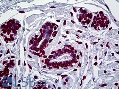 Anti-EN1 antibody IHC of human breast. Immunohistochemistry of formalin-fixed, paraffin-embedded tissue after heat-induced antigen retrieval. Antibody LS-B5400 concentration 5 ug/ml.