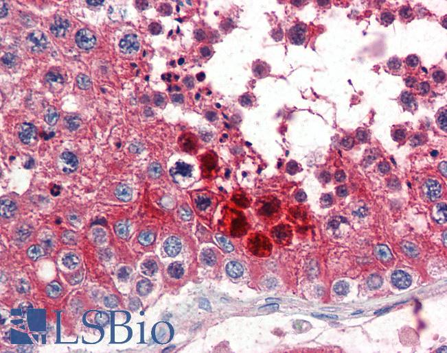 Anti-Clusterin antibody IHC of human testis. Immunohistochemistry of formalin-fixed, paraffin-embedded tissue after heat-induced antigen retrieval. Antibody LS-B2852 concentration 5 ug/ml.
