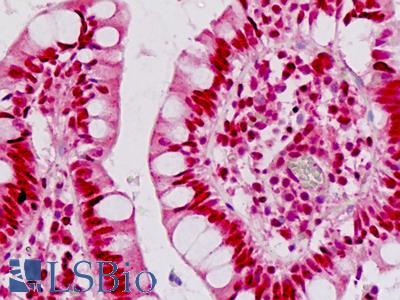 Human Small Intestine: Formalin-Fixed, Paraffin-Embedded (FFPE)