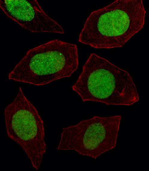 Fluorescent image of U251 cell stained with EN1 Antibody. U251 cells were fixed with 4% PFA (20 min), permeabilized with Triton X-100 (0.1%, 10 min), then incubated with EN1 primary antibody (1:25, 1 h at 37°C). For secondary antibody, Alexa Fluor 488 conjugated donkey anti-rabbit antibody (green) was used (1:400, 50 min at 37°C). Cytoplasmic actin was counterstained with Alexa Fluor 555 (red) conjugated Phalloidin (7units/ml, 1 h at 37°C). EN1 immunoreactivity is localized to Nucleus significantly.