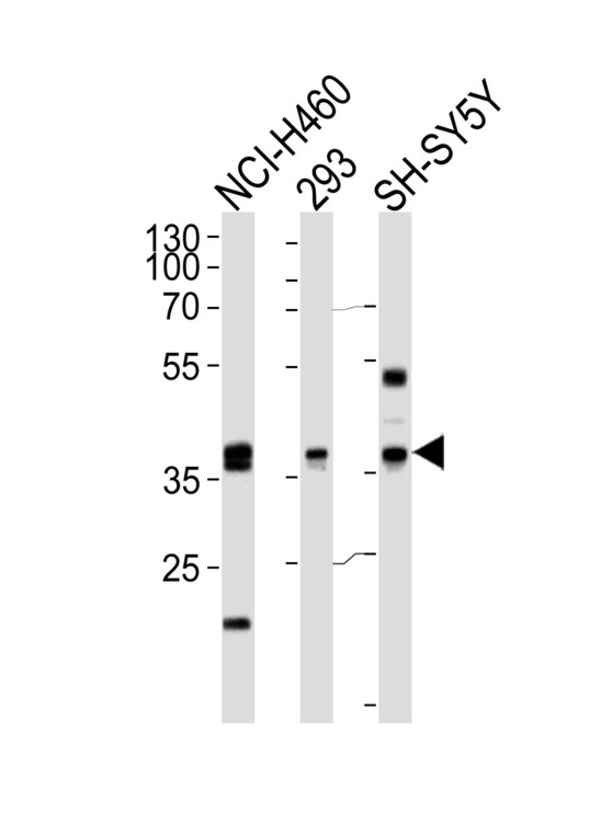 Western blot of lysates from NCI-H460,293,SH-SY5Y cell line (from left to right),using EN1 Antibody. Antibody was diluted at 1:1000 at each lane. A goat anti-rabbit IgG H&L (HRP) at 1:5000 dilution was used as the secondary antibody.Lysates at 35ug per lane.