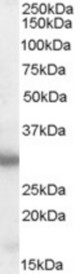Antibody (0.5 ug/ml) staining of Mouse Brain lysate (35 ug protein in RIPA buffer). Primary incubation was 1 hour. Detected by chemiluminescence.