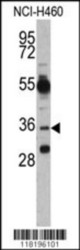 Western blot analysis of EN2 antibody (N-term) in NCI-H460 cell line lysates (35 ug/lane). EN2 (arrow) was detected using the purified Pab.