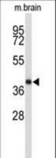 Western blot of EN2 antibody in 293 cell line lysates and mouse stomach and lung tissue lysates (35 ug/lane). EN2 (arrow) was detected using the purified antibody.