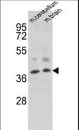 Western blot of EN2 Antibody in mouse cerebellum, brain tissue lysates (35 ug/lane). EN2 (arrow) was detected using the purified antibody.