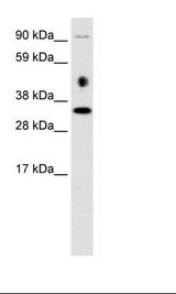 Fetal Cerebellum Lysate.