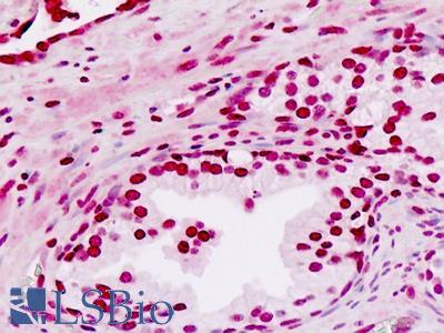 Human Prostate: Formalin-Fixed, Paraffin-Embedded (FFPE)