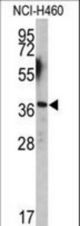 Western blot of EN2 antibody (C-term-2) in NCI-H460 cell line lysates (35 ug/lane). EN2 (arrow) was detected using the purified antibody.