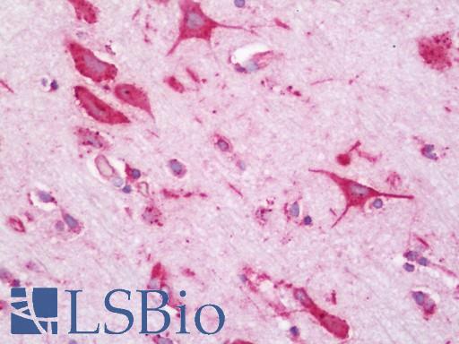 Anti-ENAH / MENA antibody IHC staining of human brain, cortex. Immunohistochemistry of formalin-fixed, paraffin-embedded tissue after heat-induced antigen retrieval. Antibody LS-B11390 dilution 1:200.