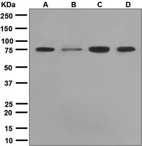 Western blot analysis on (A) MDA-MB-435, (B) MCF-7, (C) HUVEC, and (D) A431 cell lysates using anti-Mena antibody.